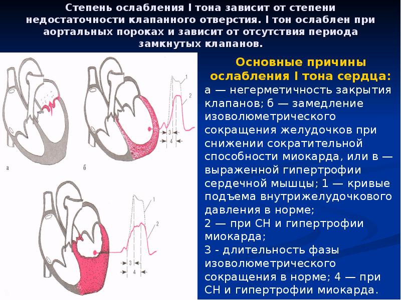 Аускультация сердца пропедевтика презентация