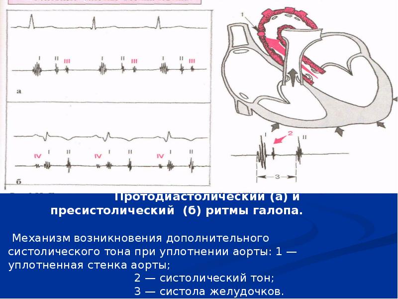 Аускультация сердца пропедевтика презентация