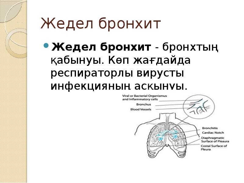 Жедел бронхит
Жедел бронхит - бронхтың қабынуы. Көп жағдайда респираторлы вирусты Жедел бронхит
Жедел бронхит - бронхтың қабынуы. Көп жағдайда респираторлы вирусты