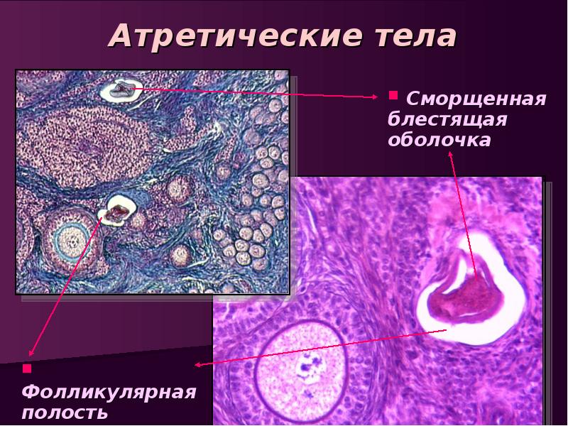 Половая система презентация