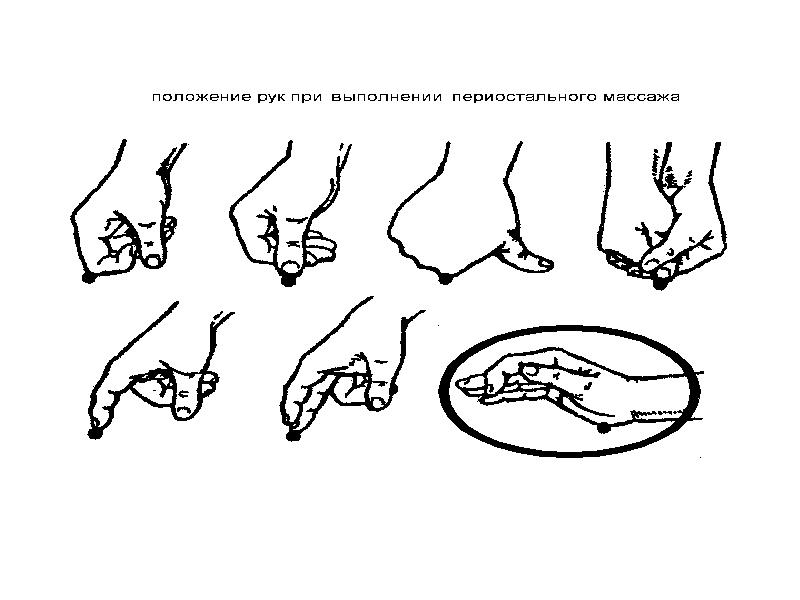 Периостальный массаж презентация