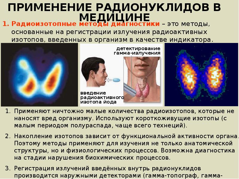 Применение изотопов в медицине презентация