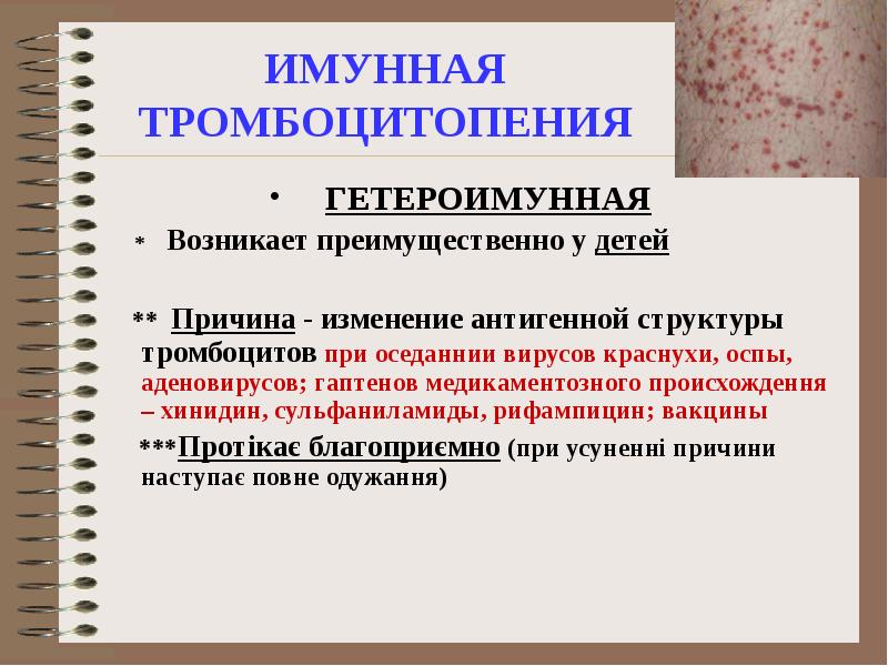 Тромбоцитопения это. Вирусиндуцированная тромбоцитопения. Иммунная тромбоцитопения. Тромбоцитопения причины. Тромбоцитопения причины возникновения у детей.