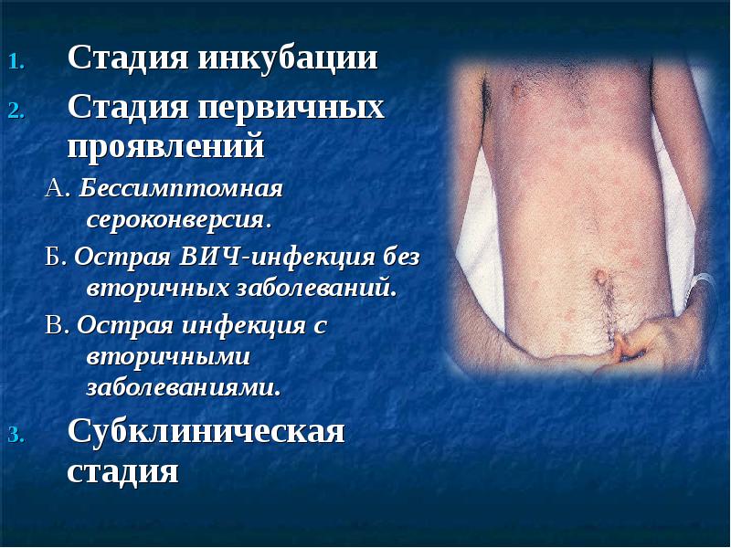 Стадия инкубации Стадия инкубации Стадия первичных проявлений А. Бессимптомная сероконверсия. 