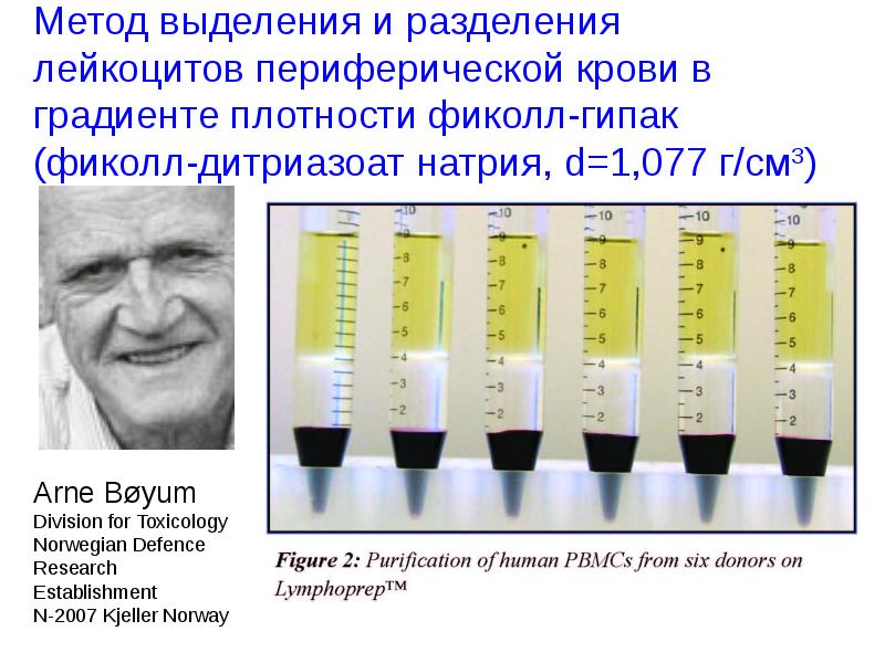 Градиент плотности. Метод выделения. Методы выделения лимфоцитов из периферической крови. Методы выделения лейкоцитов из крови. Лейкоциты периферия крови.