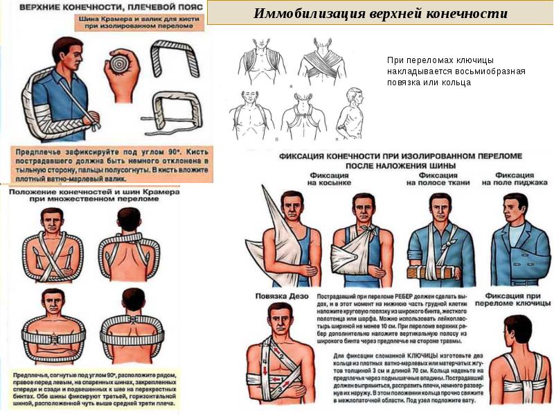 Презентация на тему неотложная помощь при переломах