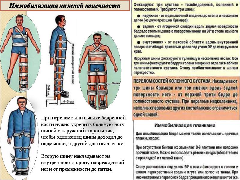 Презентация на тему неотложная помощь при переломах