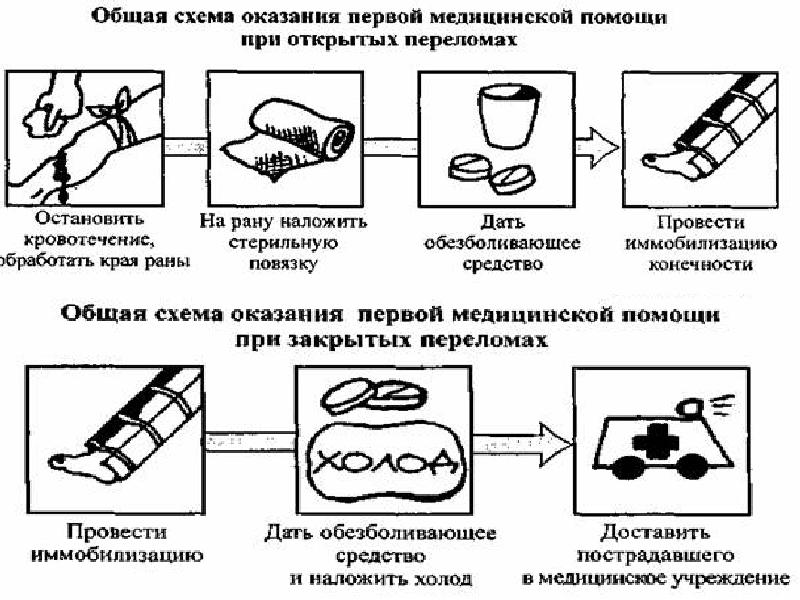 Презентация при первой медицинской помощи при переломах