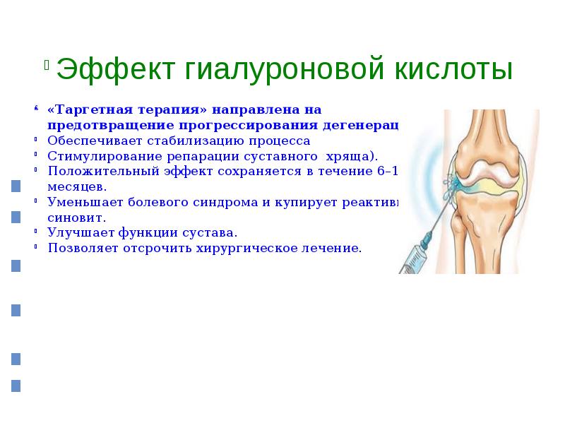 Лечение остеоартроза. Остеоартрит презентация. Остеоартроз презентация. Остеоартроз презентация терапия. Остеоартроз лекция презентация.