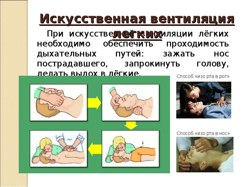 Доврачебная помощь при клинической смерти презентация