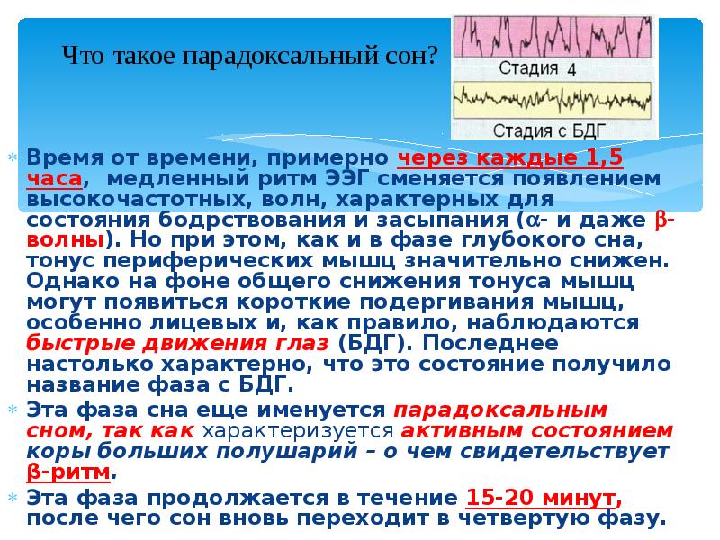 Парадоксальный сон