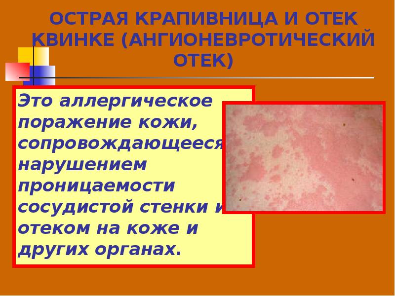 Причины нарушения кожи. Заболевания кожи инфекционные и неинфекционные.
