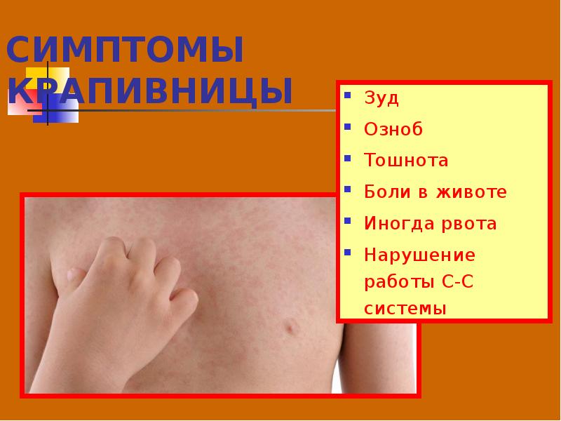 Уход за детьми с заболеваниями кожи презентация