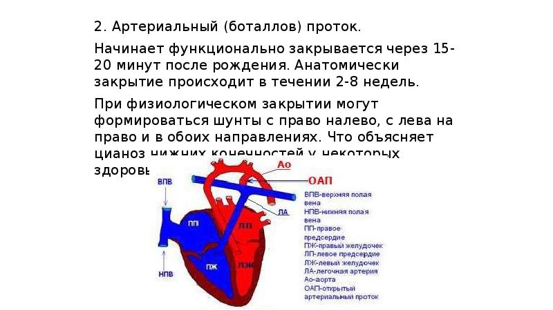 Артериальный проток у новорожденных