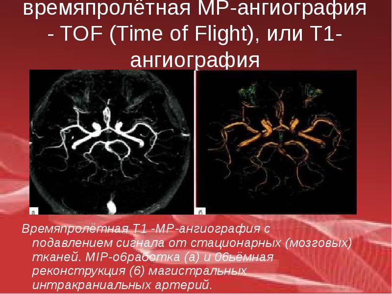 Бас неврология презентация