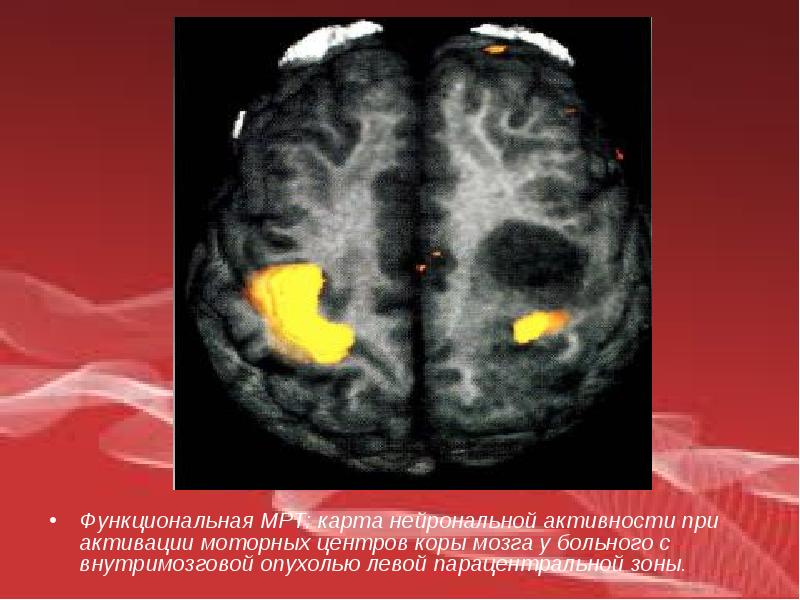 Функциональная мрт презентация