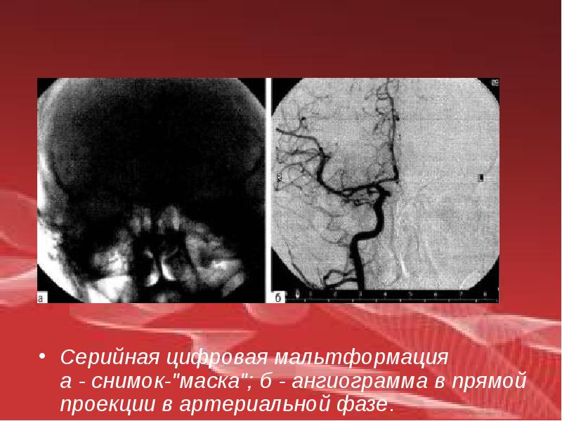 Бас неврология презентация