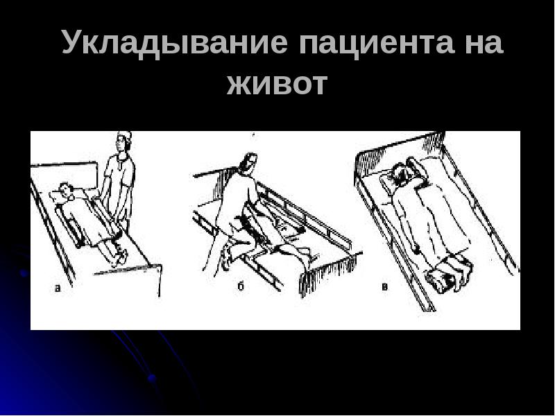Укладывание пациента на живот Укладывание пациента на живот