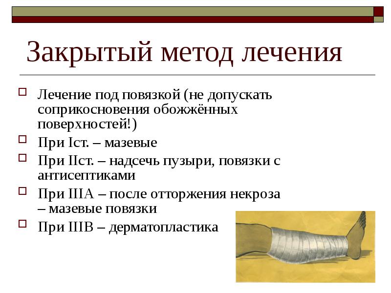 Закрытые методы. Термические повреждения презентация. Методы лечения чумы мазевые повязки на бубоны.