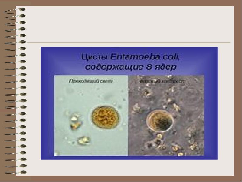 Презентация амебиаз микробиология