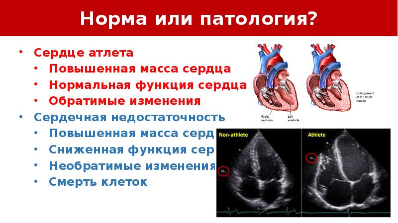 Спортивное сердце презентация