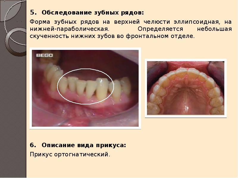История болезни по стоматологии бюгельного протеза