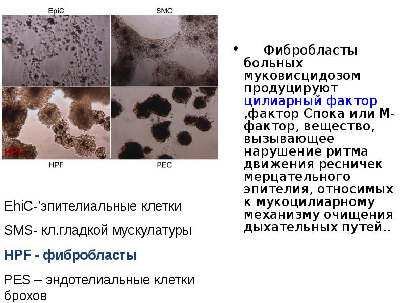 В одной европейской популяции муковисцидоз. Система очистки легких при муковисцидозе. Кариотип фибробластов после УФ облучения. Муковисцидоз презентация. Барабанные палочки почему при муковисцидозе фибробласты.