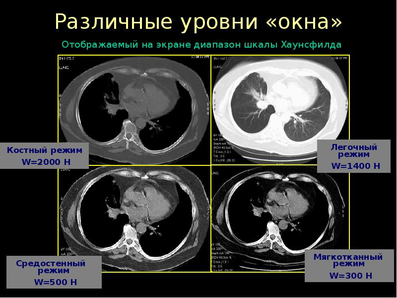 Лучевая диагностика в неврологии презентация