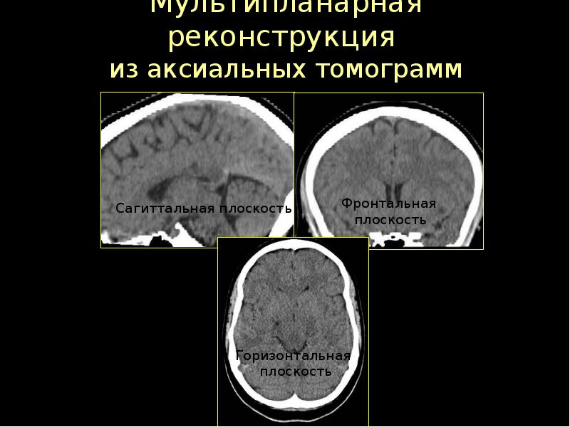 Лучевая диагностика головного мозга презентация