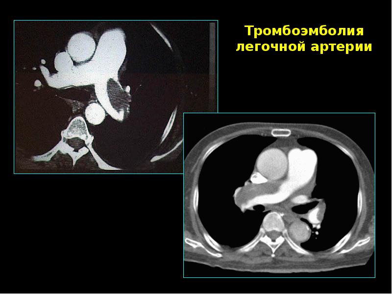 Лучевая диагностика презентация