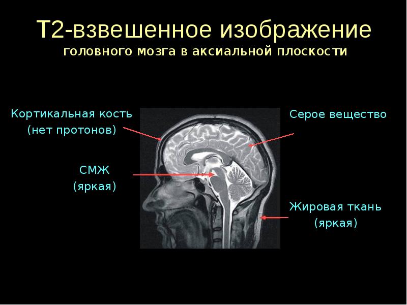 Режимы мрт презентация