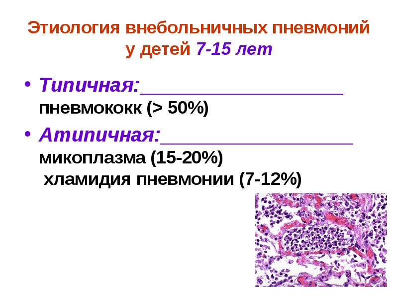 Атипичные пневмонии у детей презентация