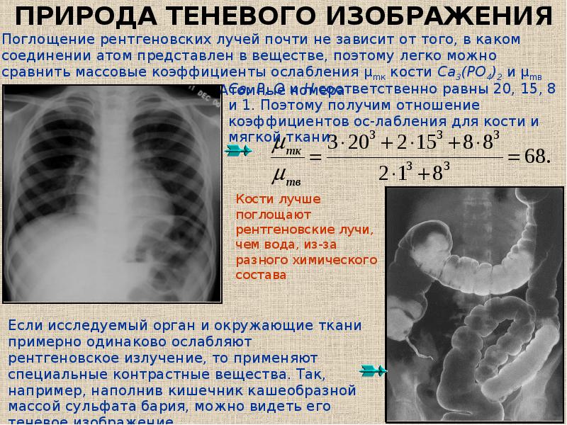 Характеристика изображений на рентгенограммах