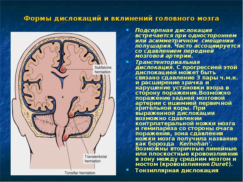 Отеки у детей презентация