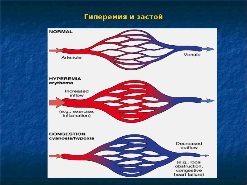 Отеки у детей презентация