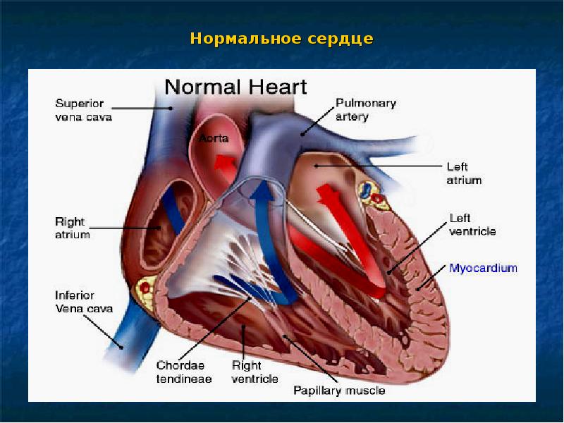 Отеки у детей презентация