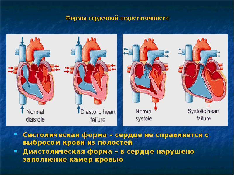 Отеки у детей презентация