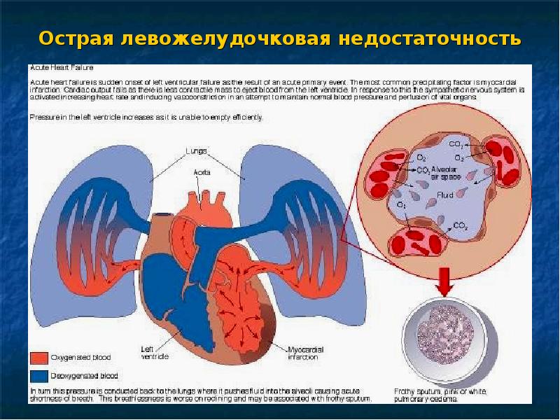 Отеки у детей презентация