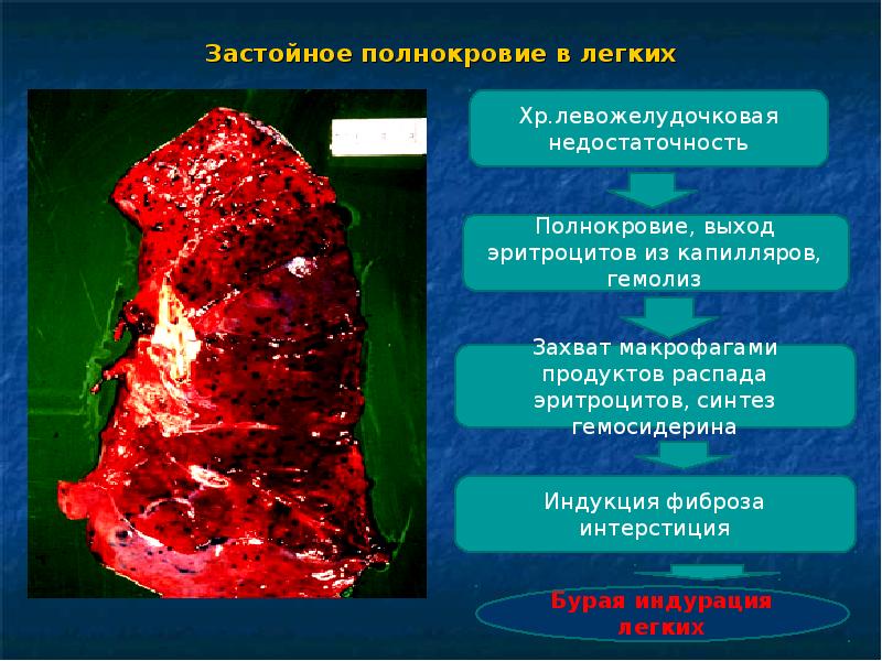 Презентации на тему отеки