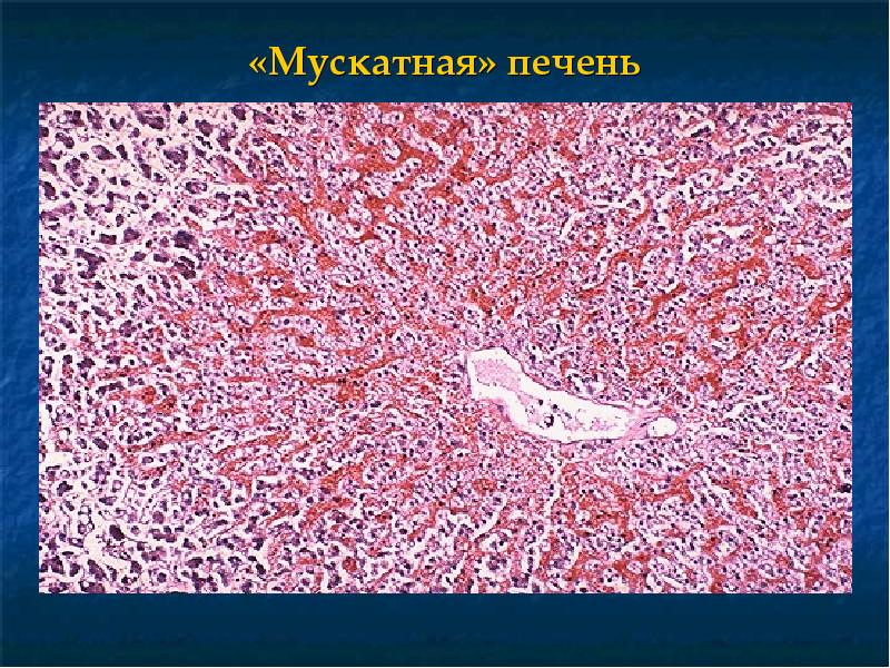 Презентации на тему отеки