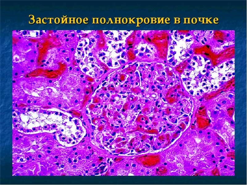 Презентации на тему отеки