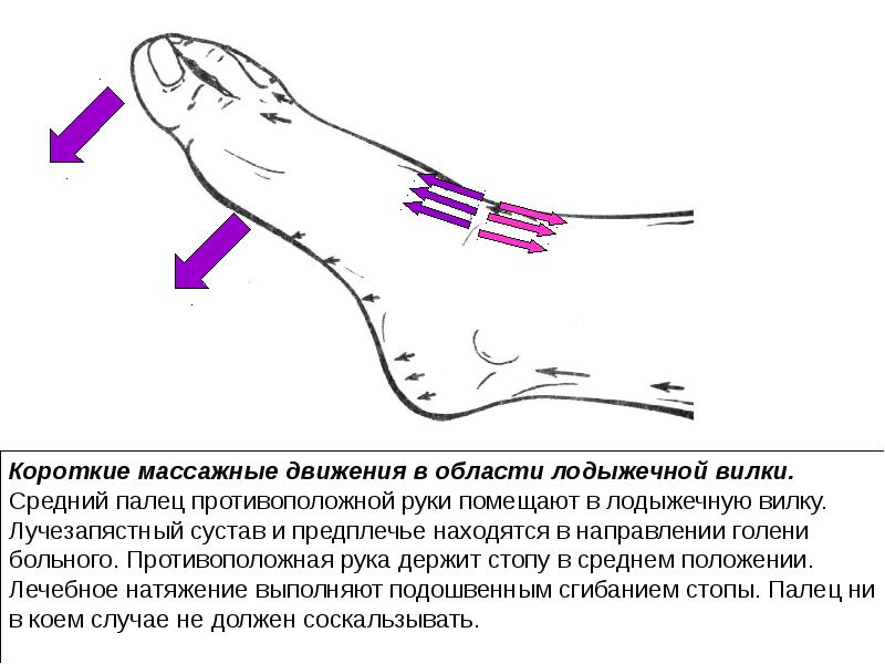 Положение подошвенного сгибания