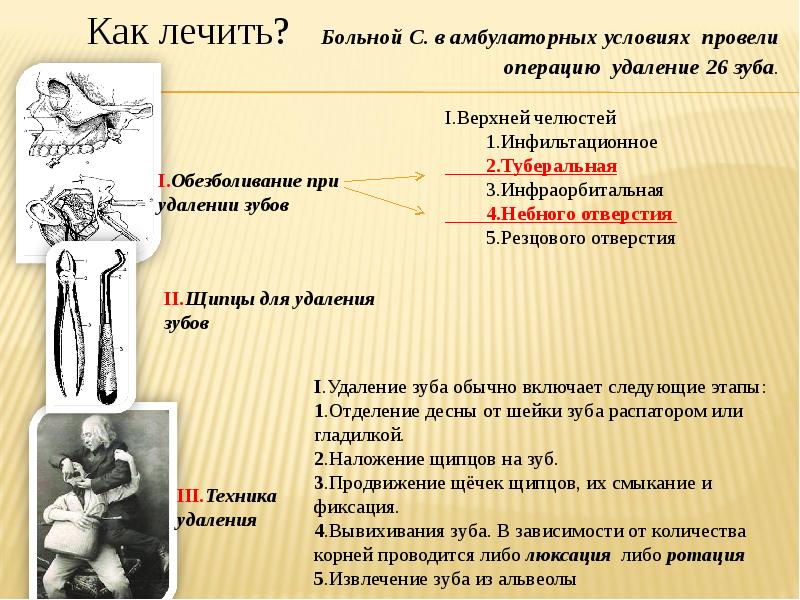 Осложнения при удалении зубов презентация