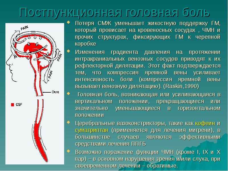 Эпидуральная анестезия презентация