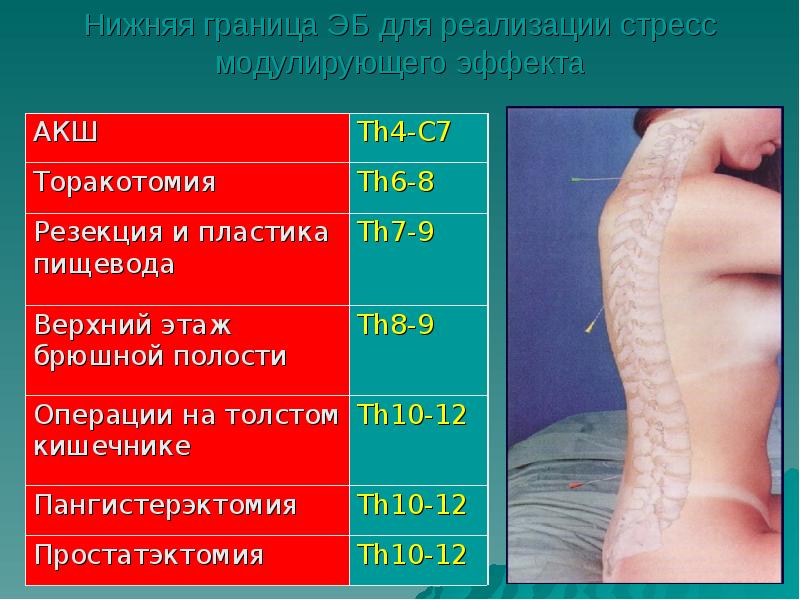 Уровни эпидуральной анестезии. Спинальная анестезия дерматомы. Спинальная анестезия l1-l2. Эпидуральная анестезия th12-l1. Спинальная анестезия уровень обезболивания.