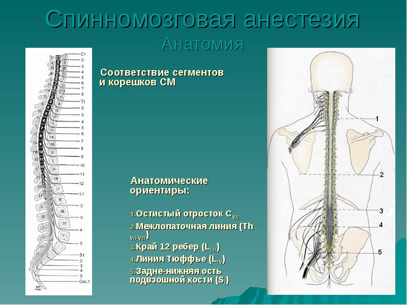 Эпидуральная анестезия презентация