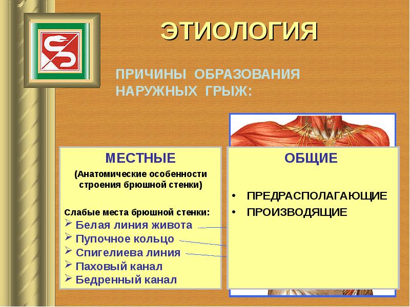 Грыжи передней брюшной стенки у детей презентация