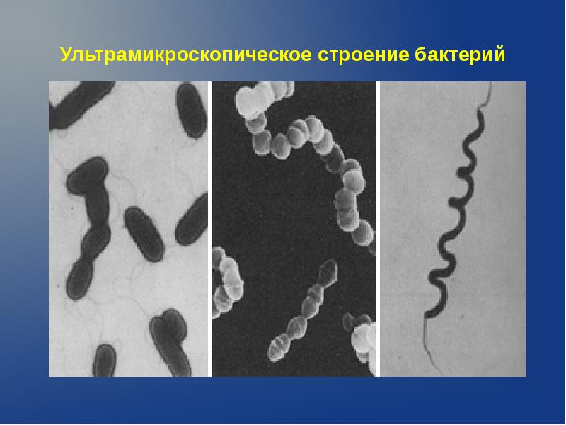 Бактерии и углерод. Фитопатогенные микроорганизмы микробиология. Фитопатогенные бактерии. Стебельковые бактерии. Стебельковые бактерии строение.