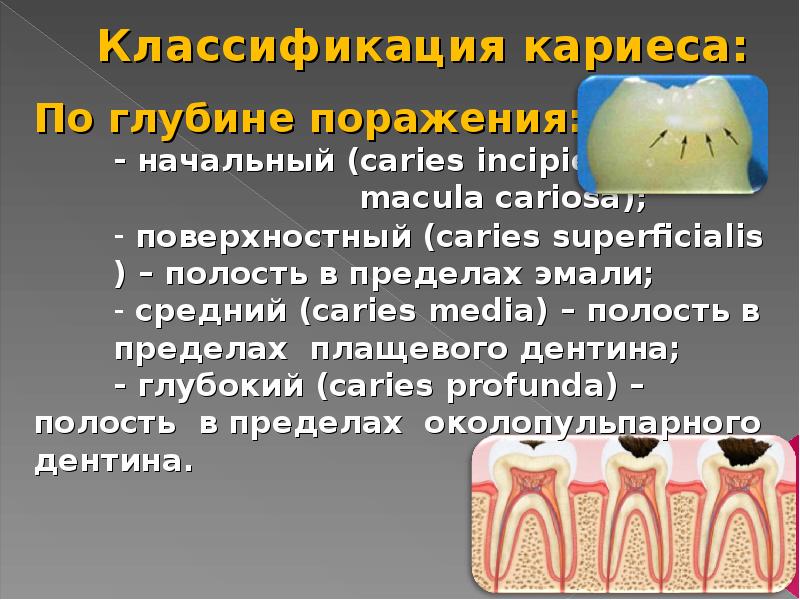 Классификация кариеса презентация