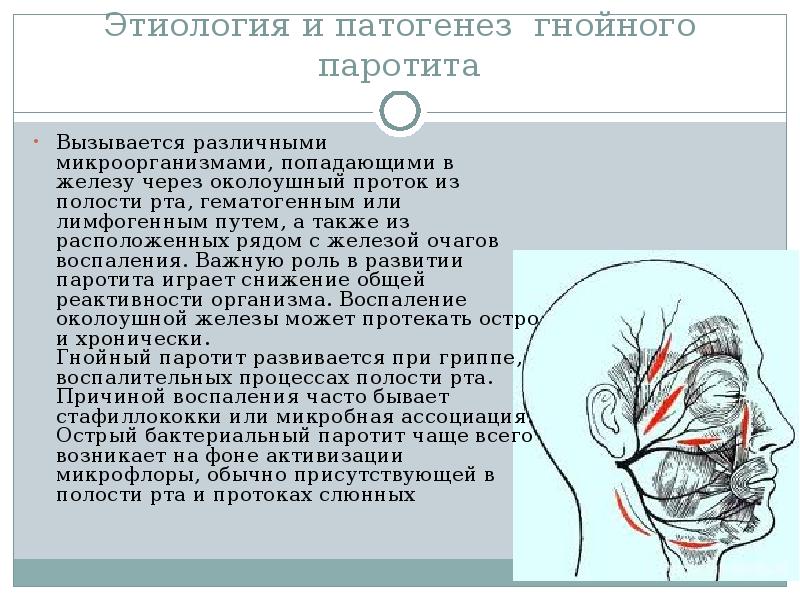 Околоушной паротит. Разрезы при Гнойном паротите. Вскрытие Гнойного паротита. Гнойный паротит разрез. Вскоытие Гнойного паротита.